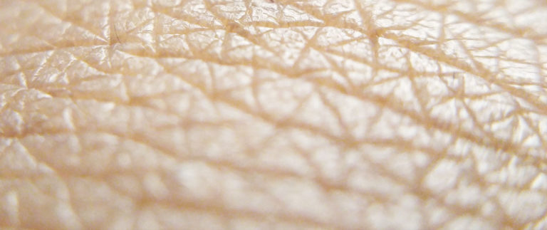 4 Tipps für die Pflege von Personen mit Atopischer Dermatitis und Psoriasis